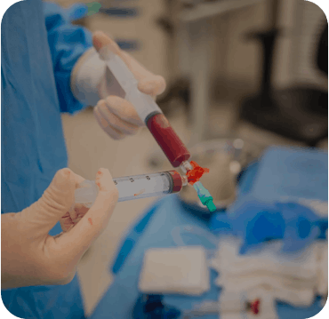 Aspirado de medula óssea BMA em medicina regenerativa