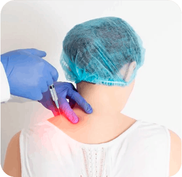 Bloqueio de nervos periféricos guiado por ultrassom para dor neuropática, neuralgia, queimação e irradiação em casos selecionados.