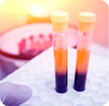 PRP plasma rico em plaquetas em medicina regenerativa