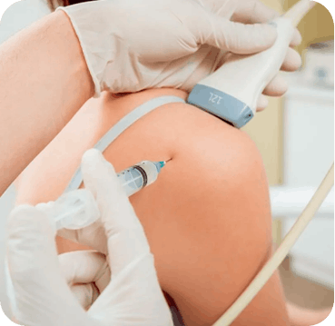 Infiltração guiada por ultrassom para tratamento da dor